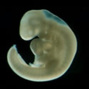 4. týden těhu.